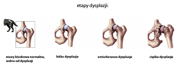 dysplazja